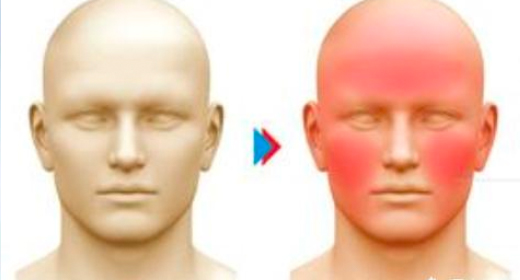 臉紅耳赤是常見的副作用